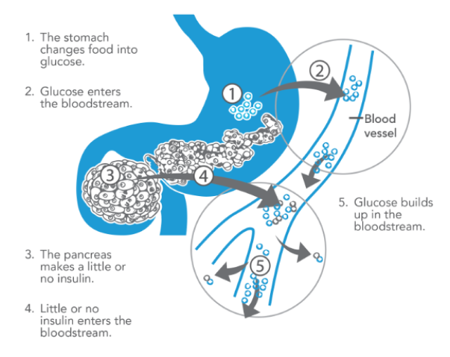 what is insulin