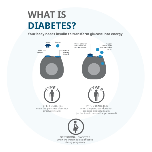 Risk Factors Of Getting Gestational Diabetes